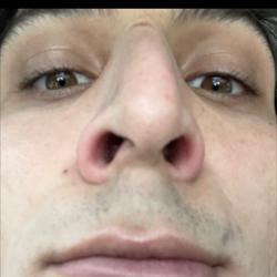 Clubhouse profile picture for @proctologist
