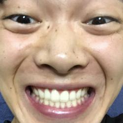 かむかむ レモン Clubhouse